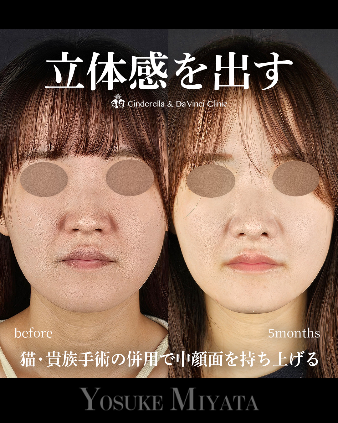 立体感を出すの画像