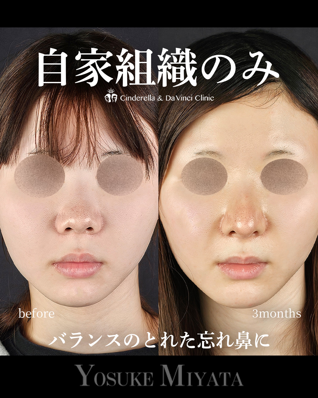 自家組織のみの画像