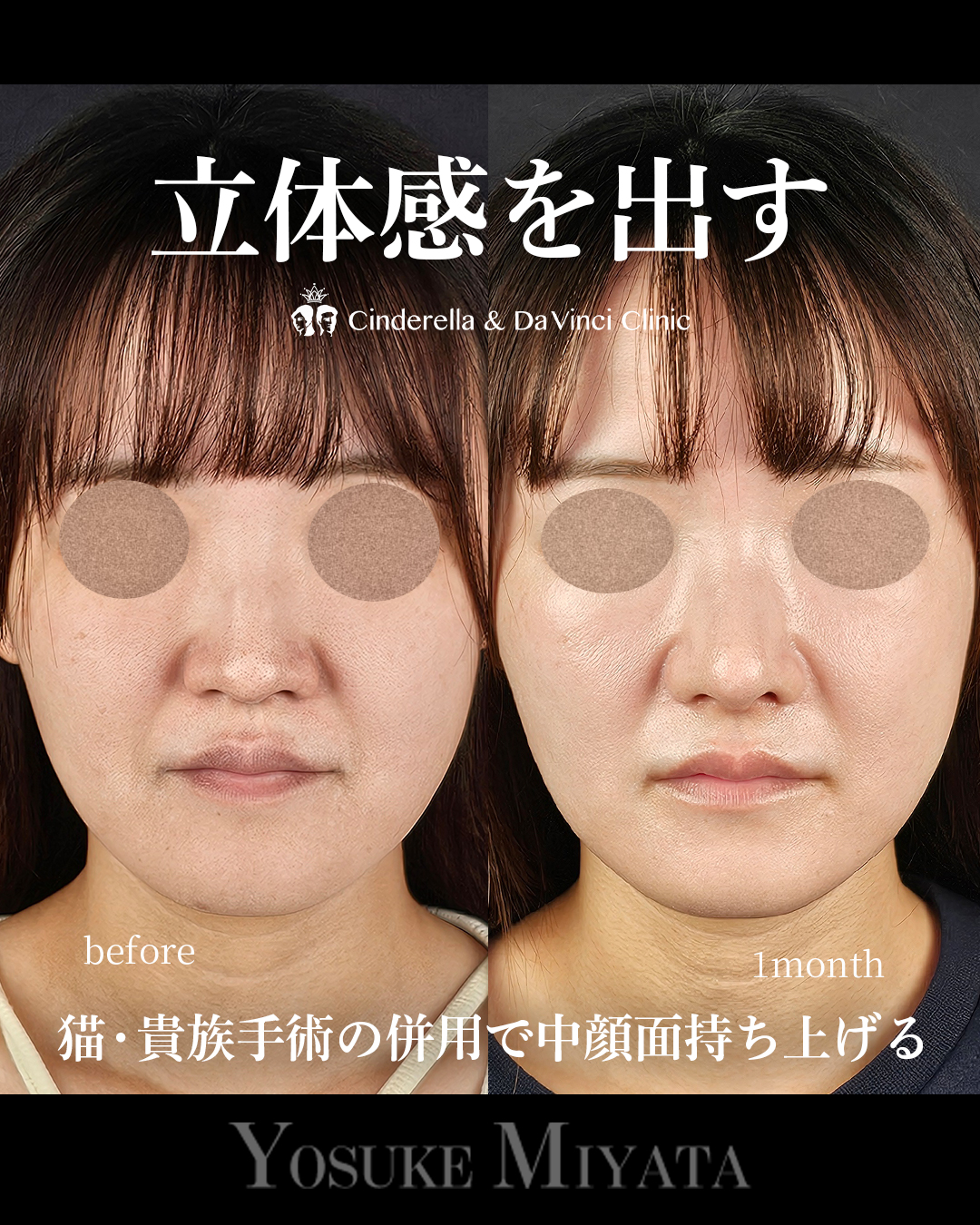 立体感を出すの画像