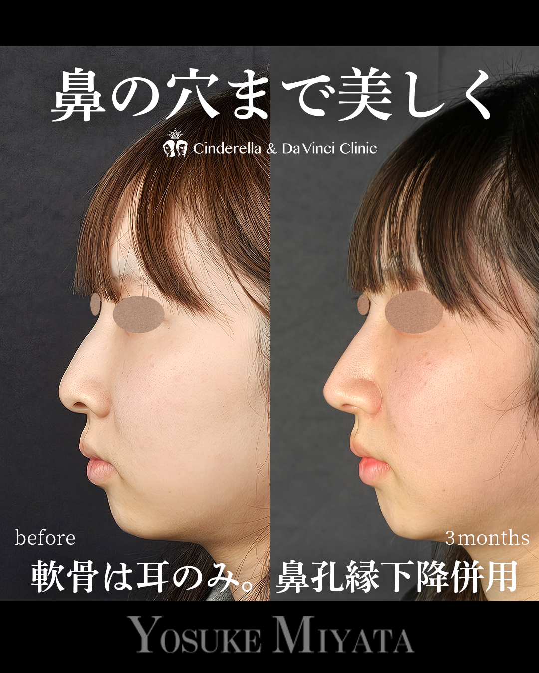 鼻の穴まできれいにの画像