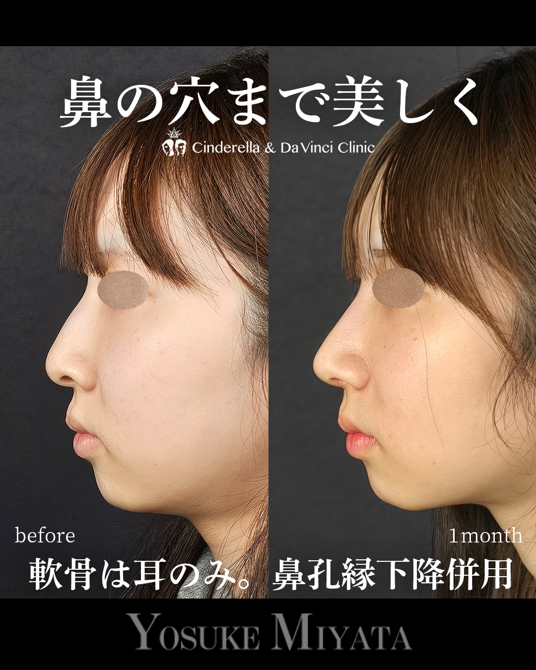 鼻の穴まできれいにの画像