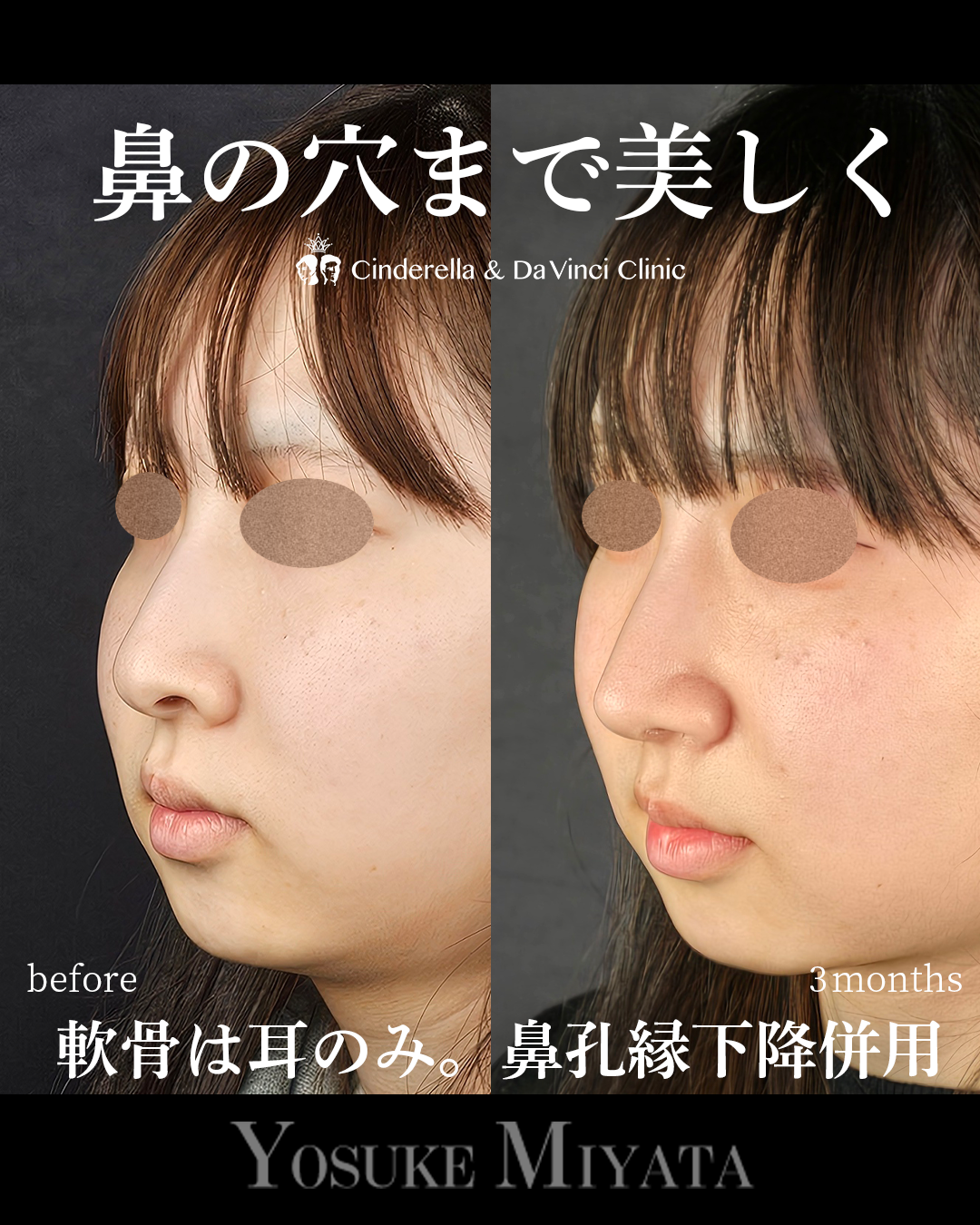 鼻の穴まできれいにの画像