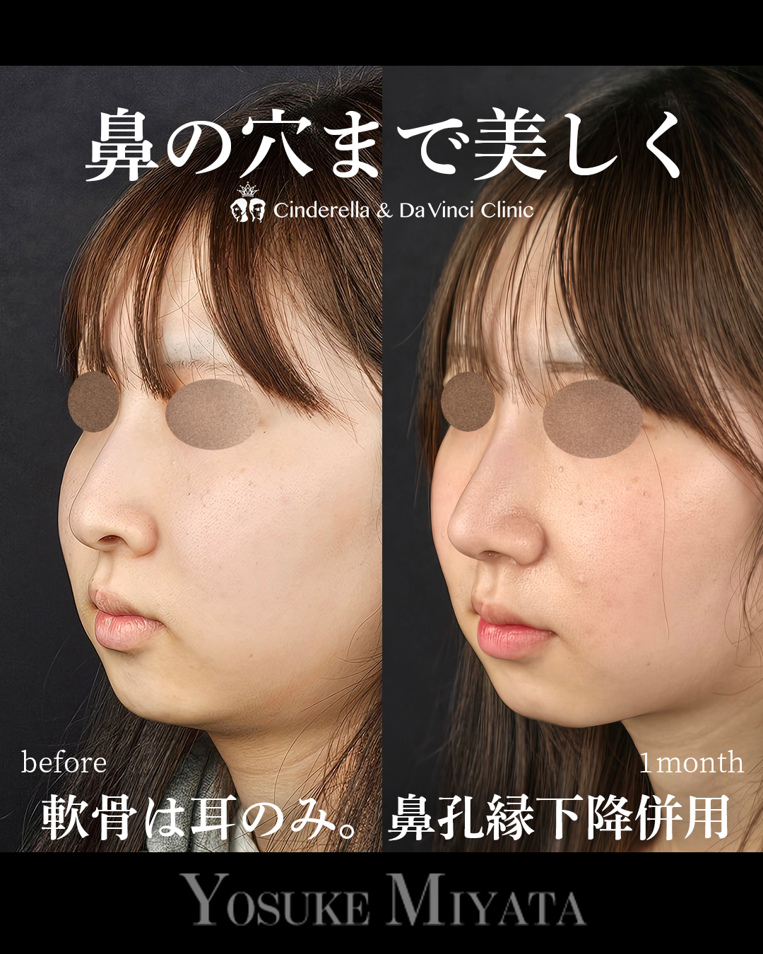 鼻の穴まできれいにの画像