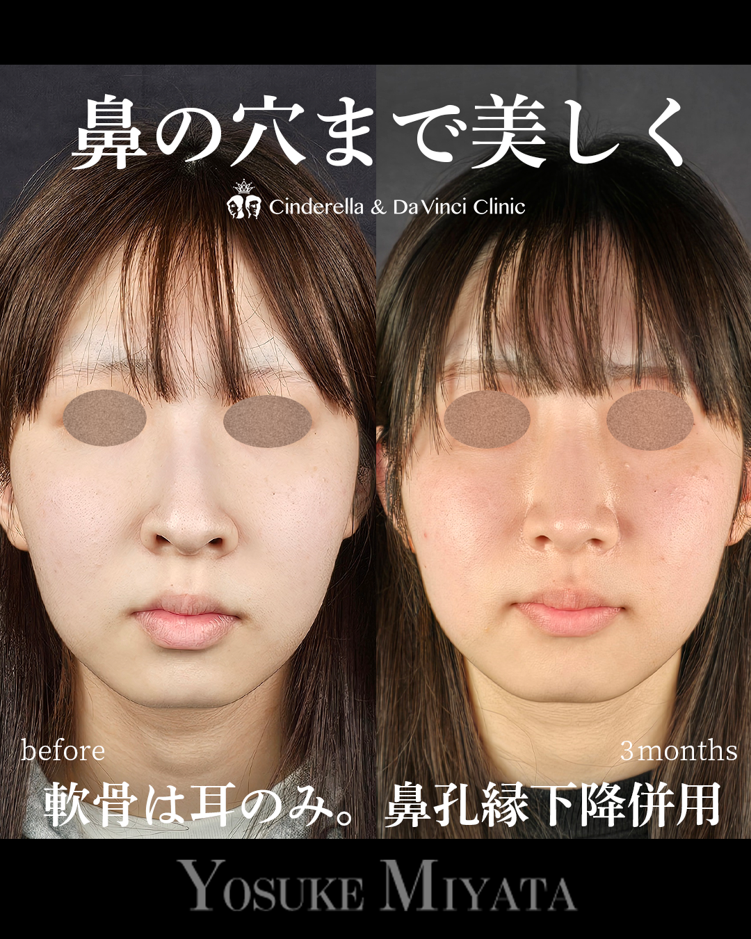 鼻の穴まできれいにの画像