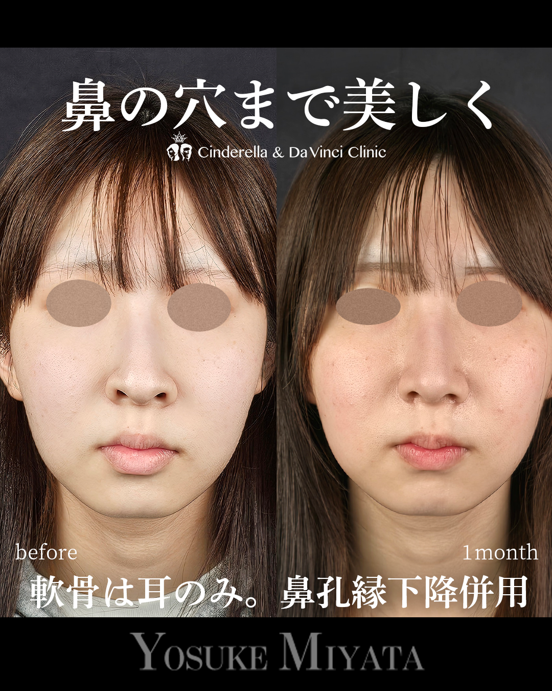 鼻の穴まできれいにの画像