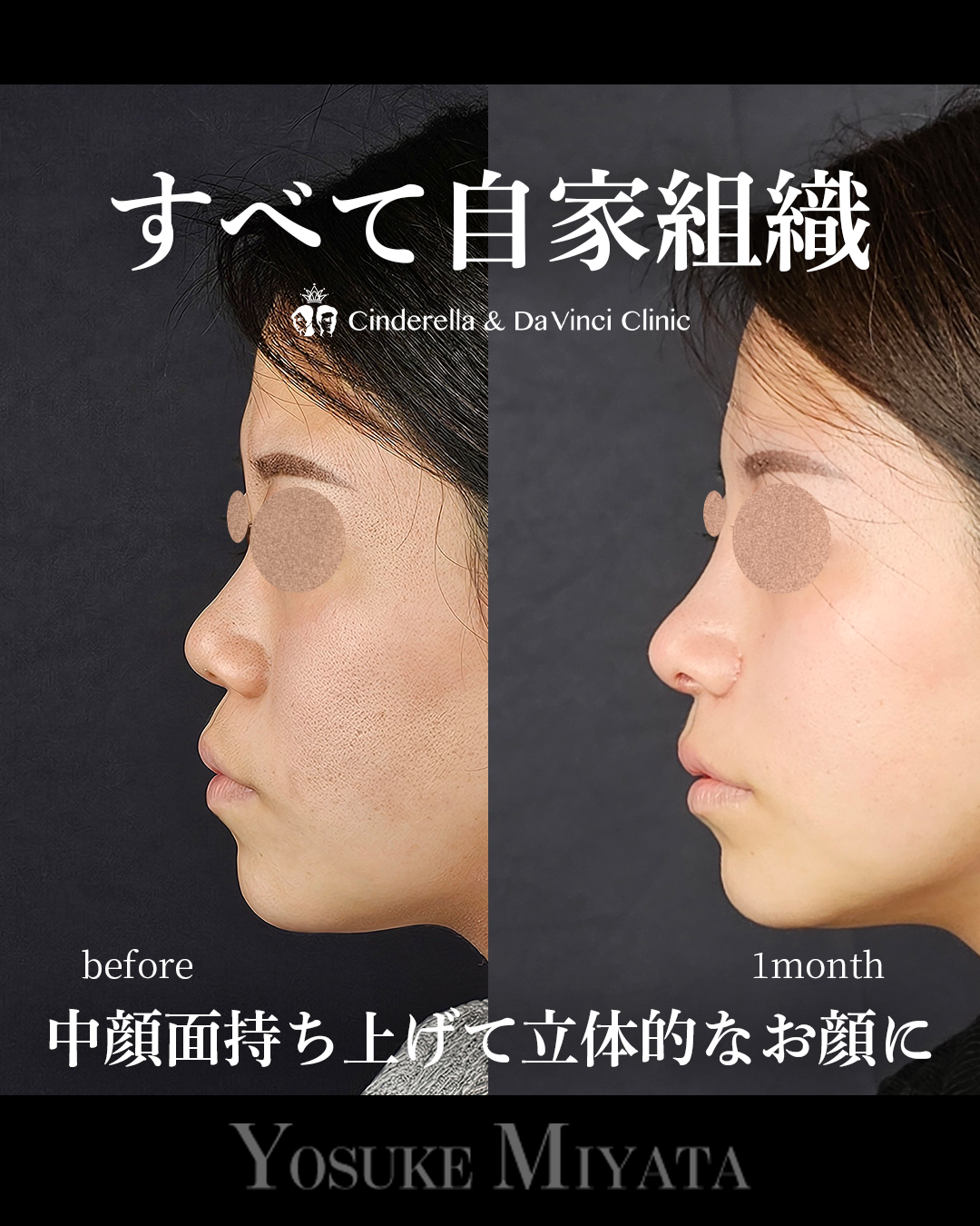 自家組織のみの画像