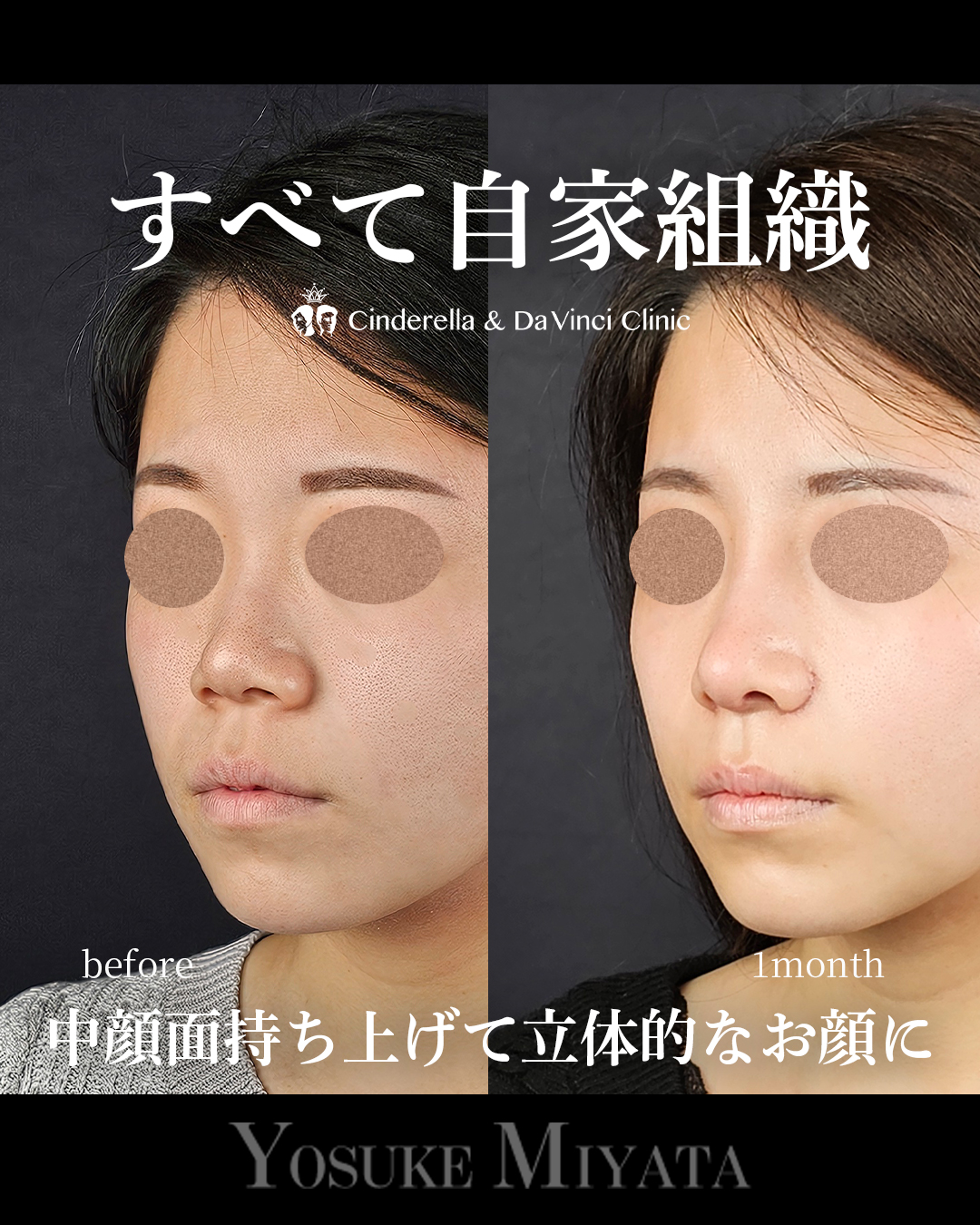 自家組織のみの画像