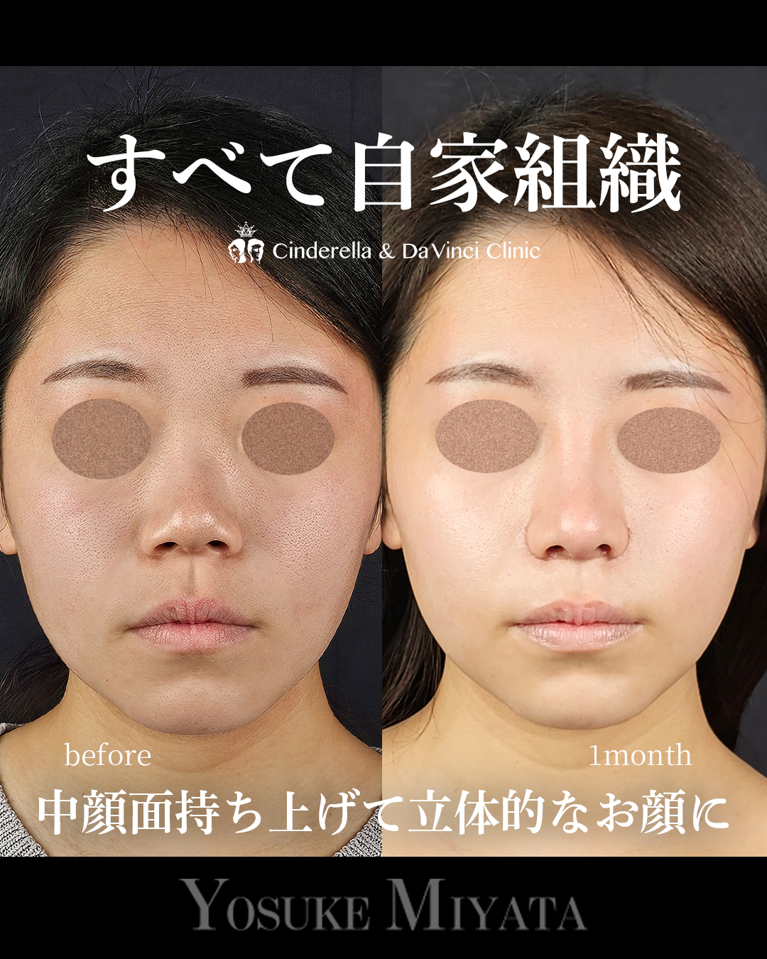 自家組織のみの画像