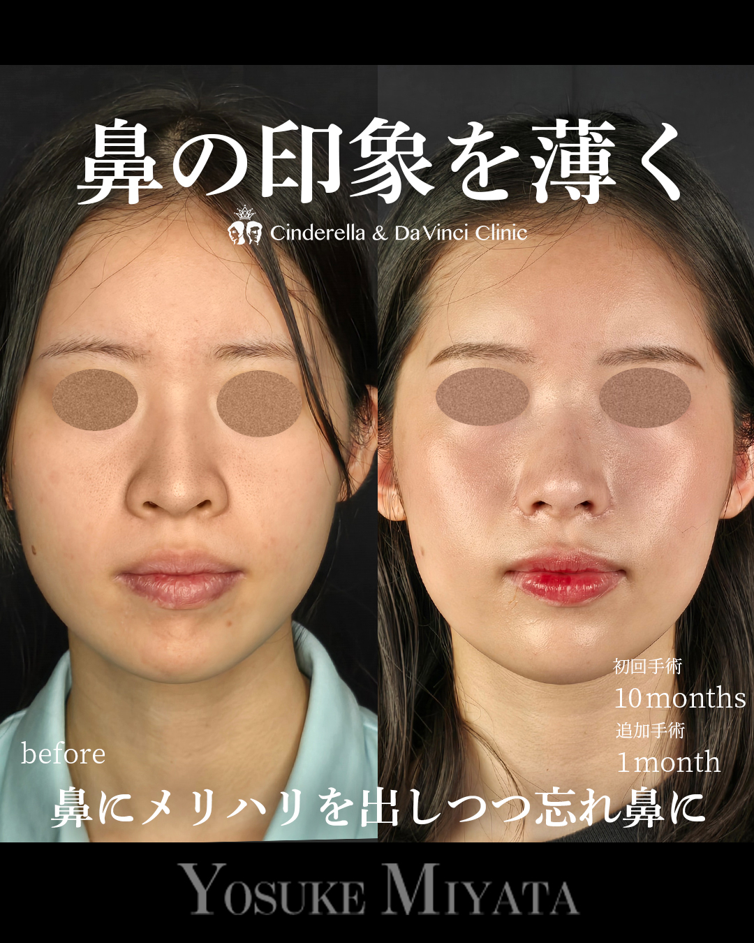 お鼻スッキリの画像