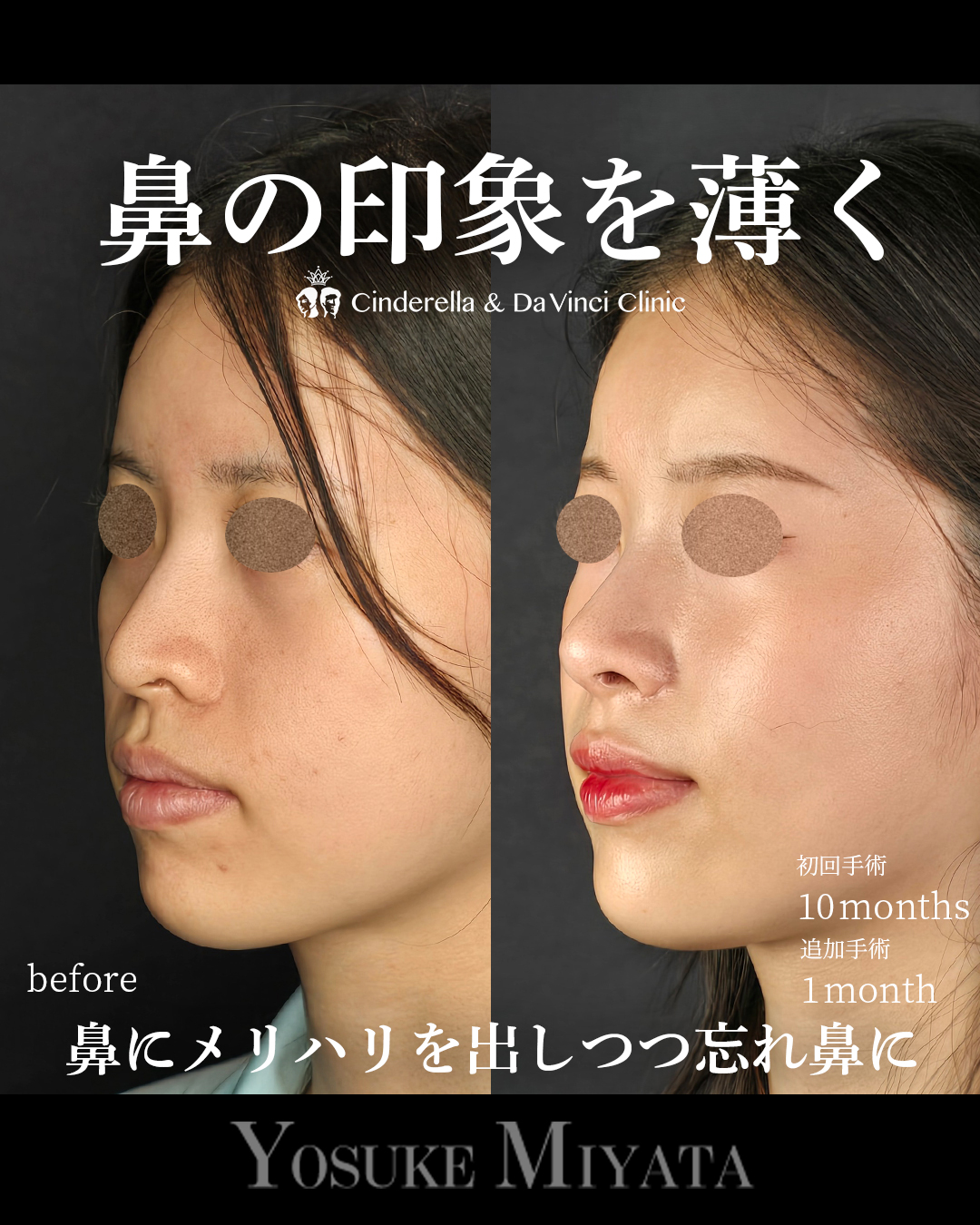 お鼻スッキリの画像