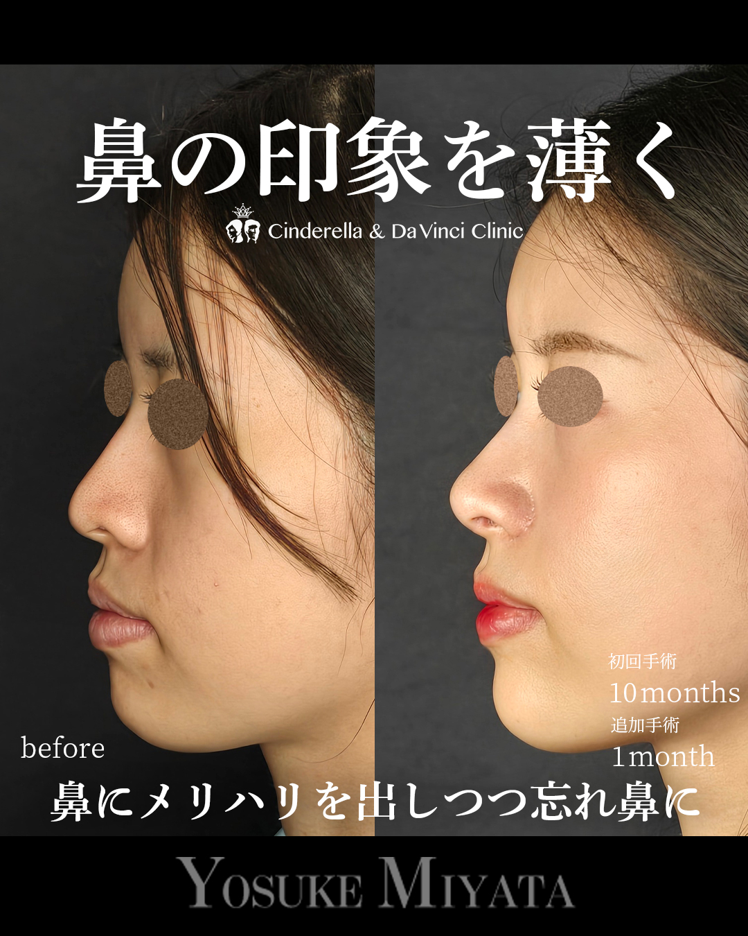 お鼻スッキリの画像