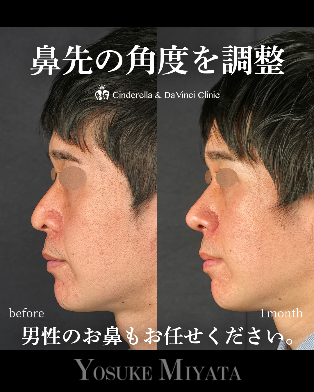 鼻先をツンとさせる