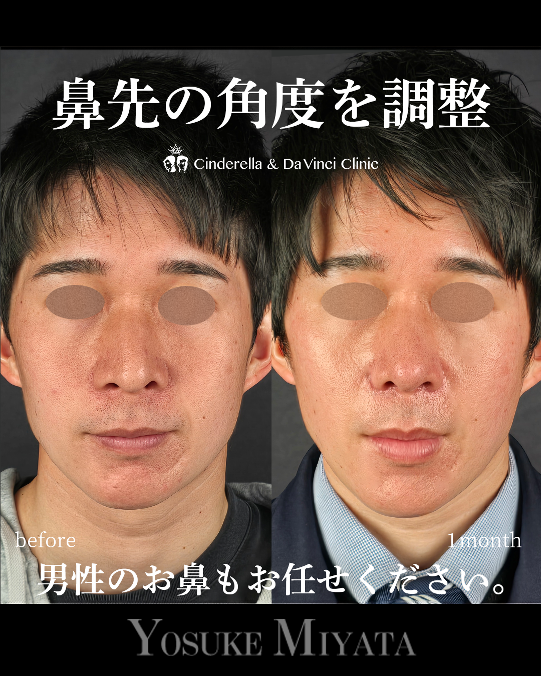 鼻先をツンとさせるの画像