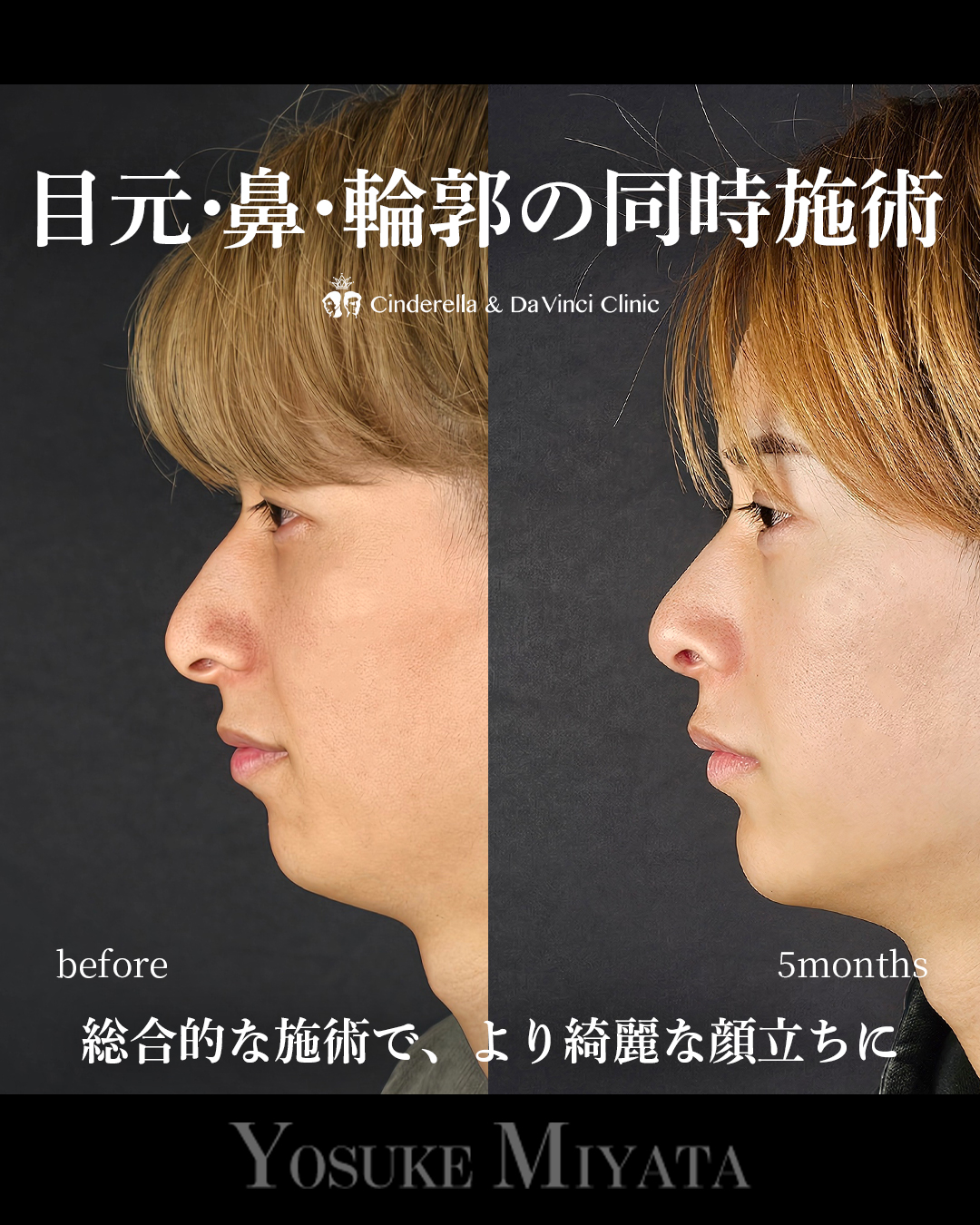 お顔全体アプデの画像