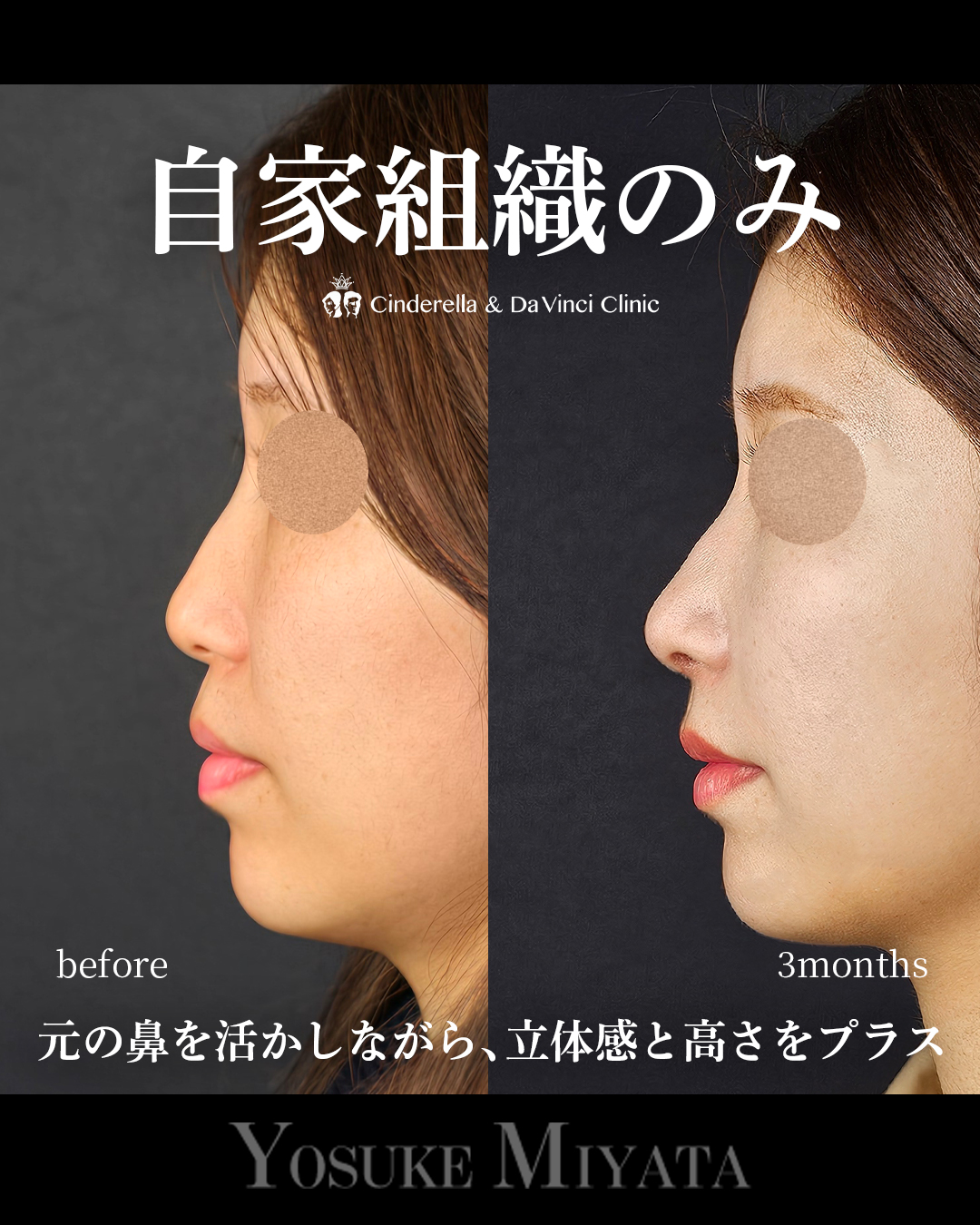 自家組織のみの画像