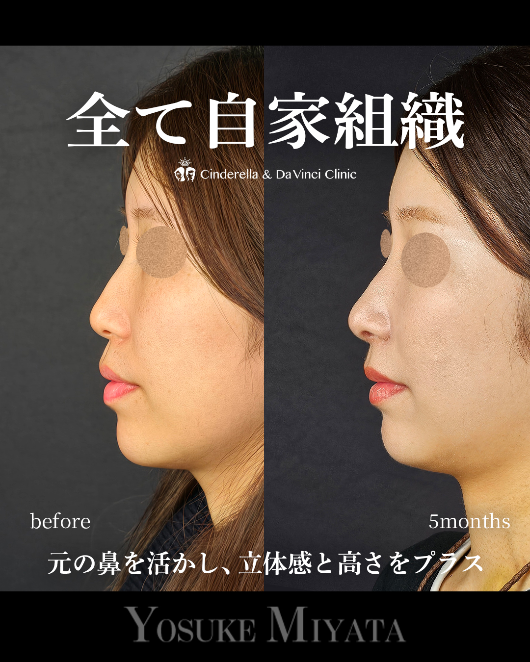 自家組織のみの画像