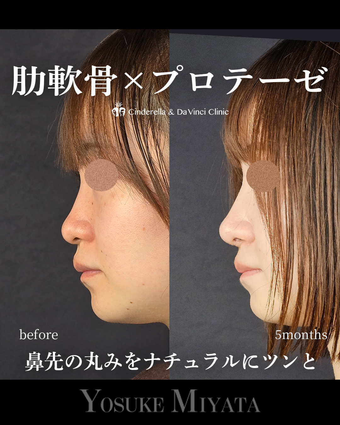 鼻先の丸みをツンとの画像