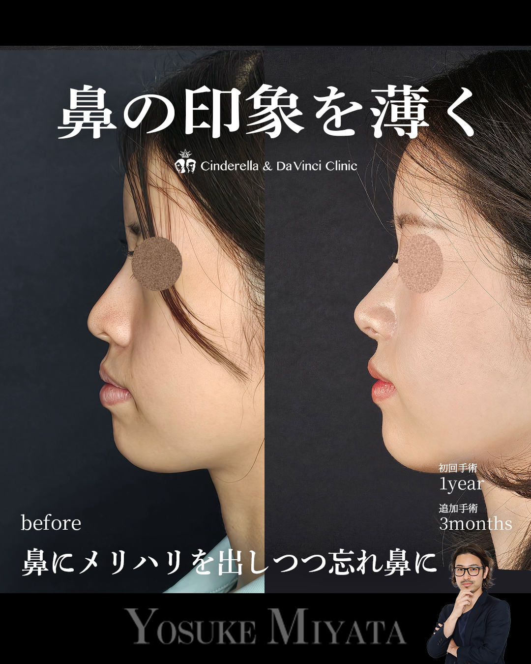 お鼻スッキリの画像