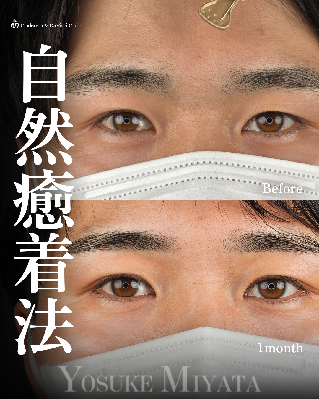 自然な男性の二重