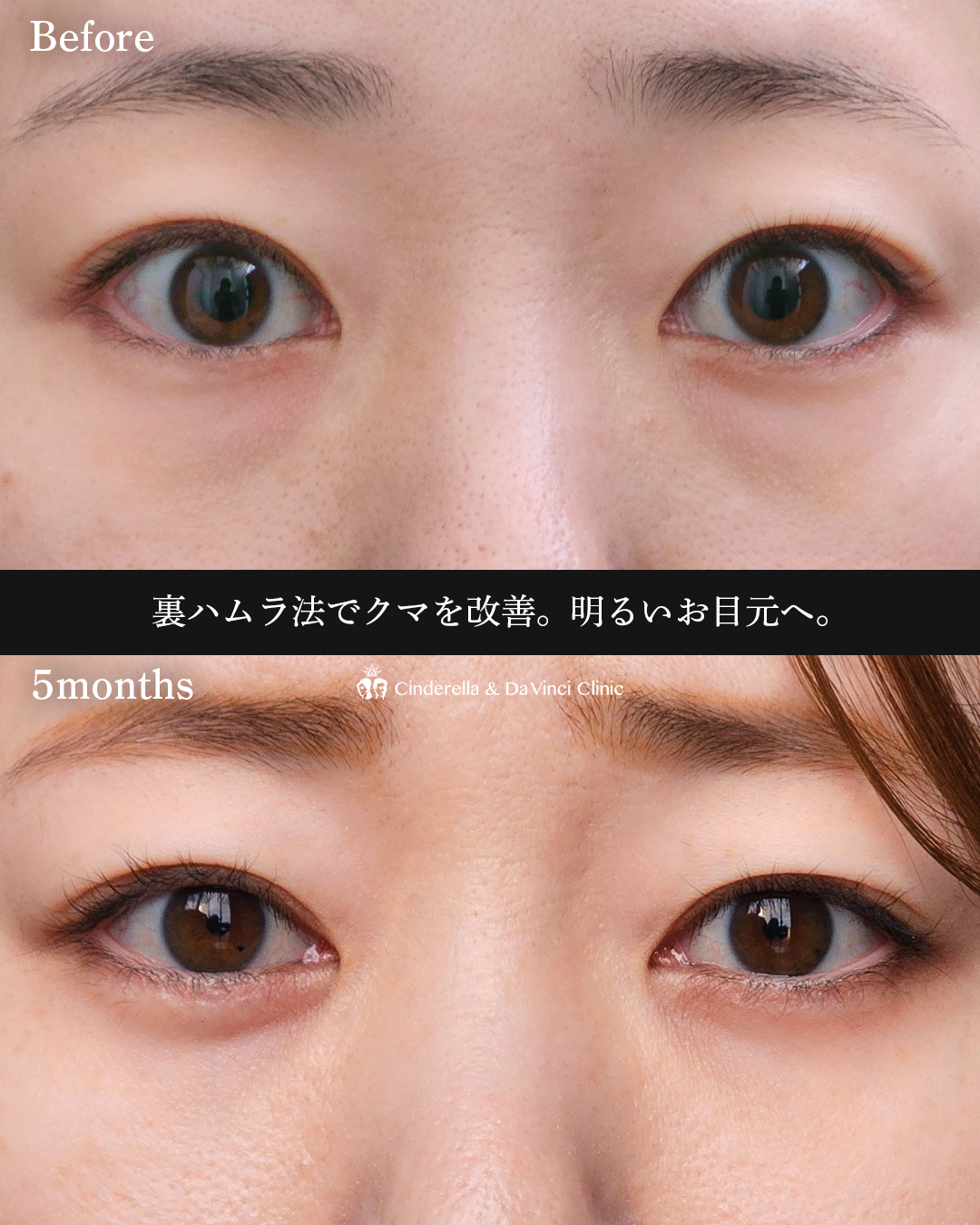 クマ改善の画像