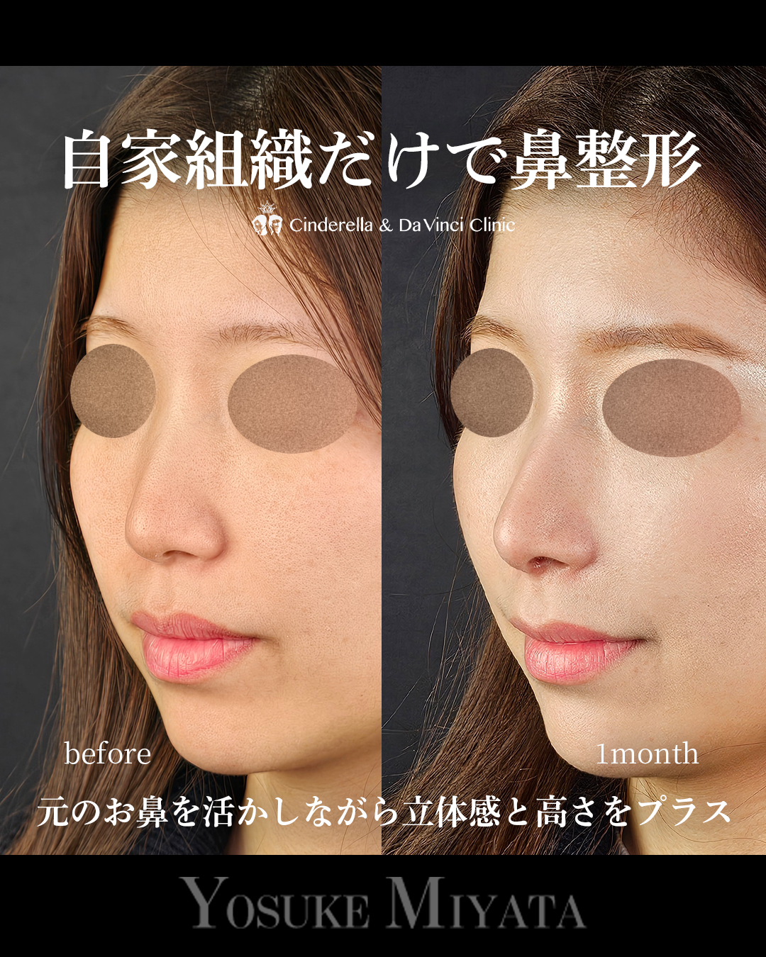 自家組織のみの画像