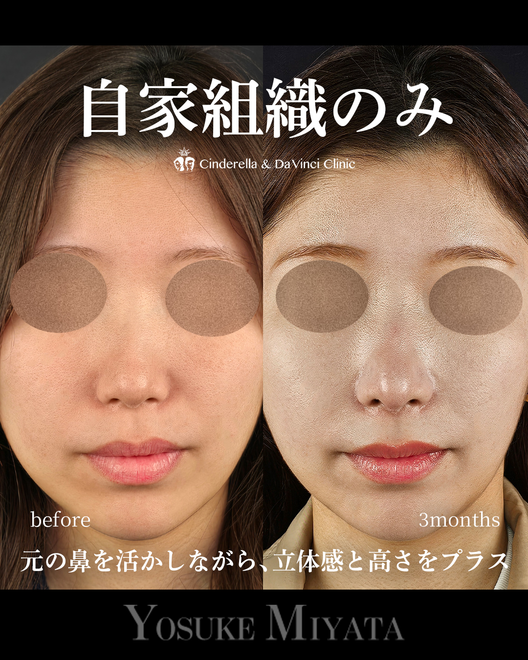自家組織のみの画像