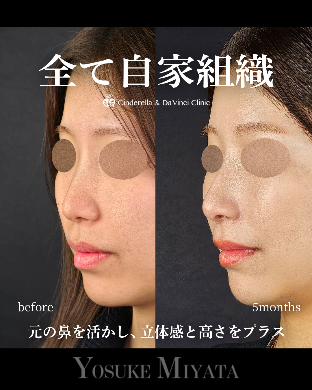 自家組織のみの画像