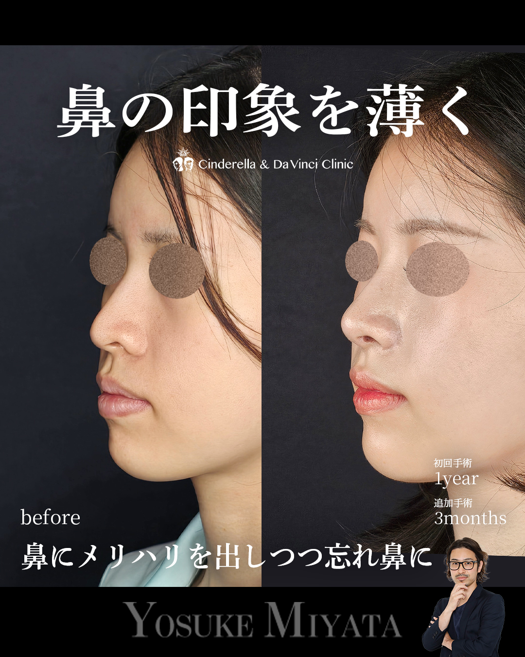 お鼻スッキリの画像