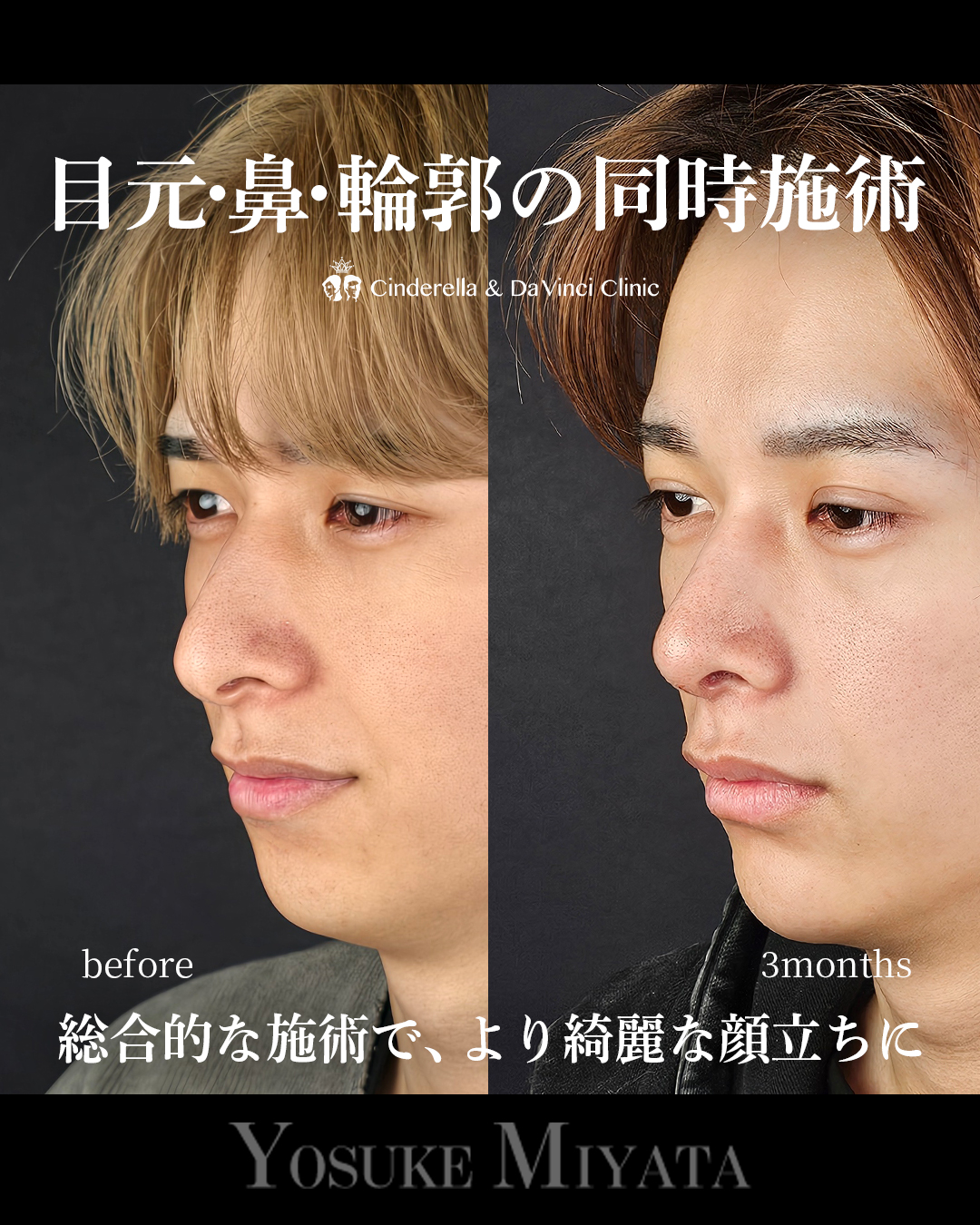 お顔全体アプデの画像