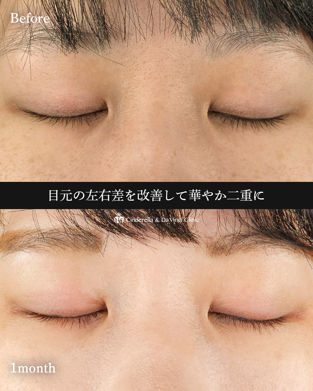 左右差改善の画像