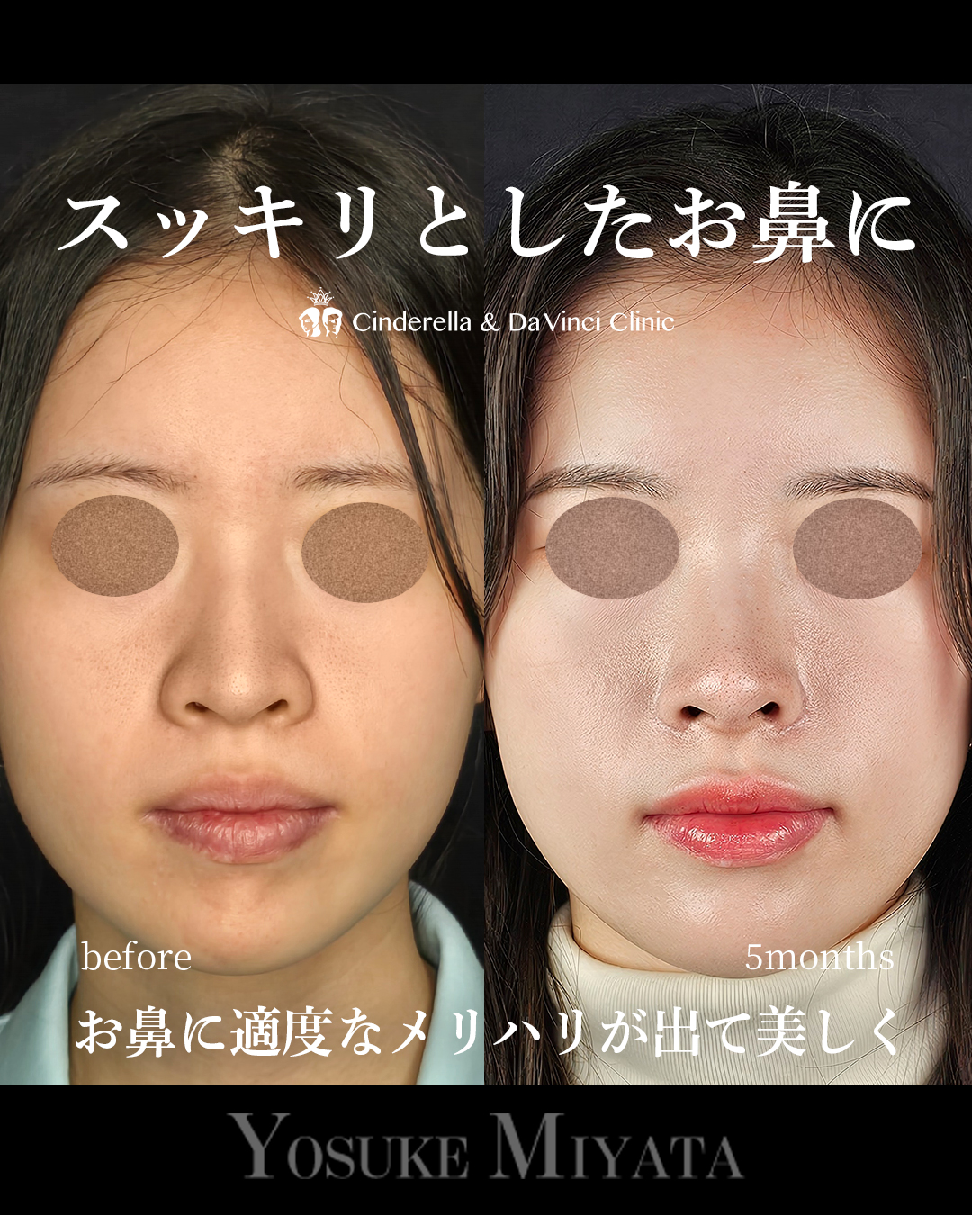 お鼻スッキリの画像