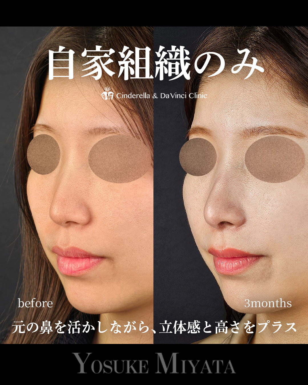 自家組織のみの画像