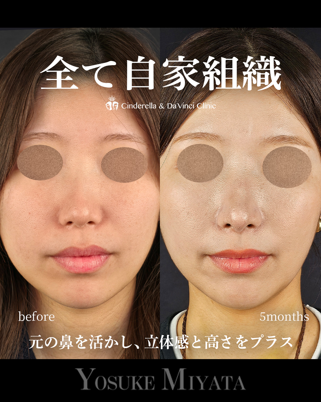 自家組織のみの画像