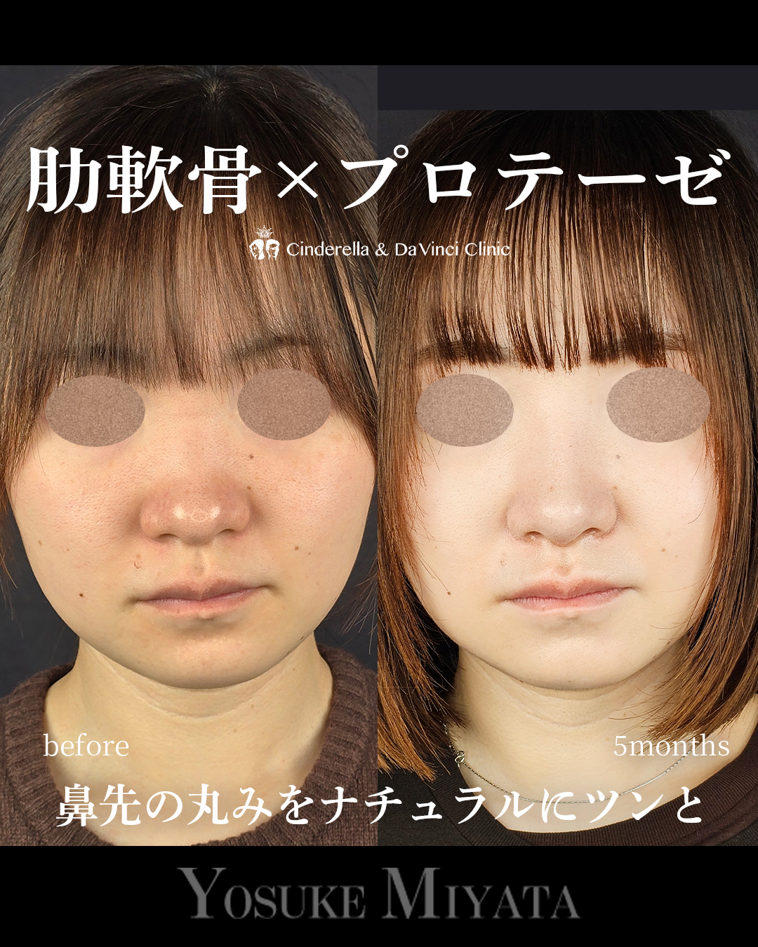 鼻先の丸みをツンとの画像
