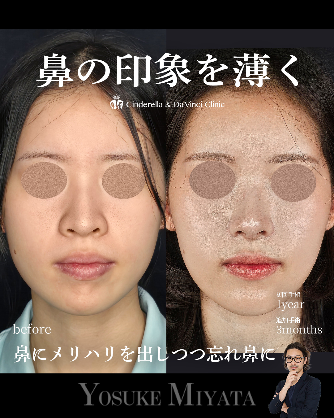 お鼻スッキリの画像