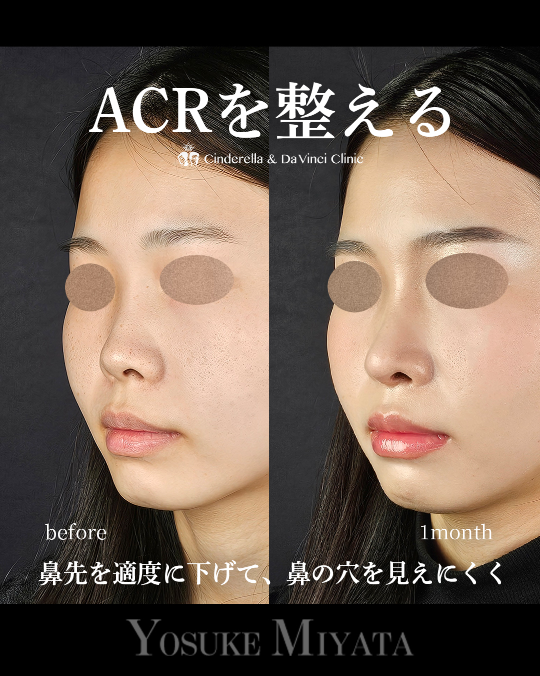 ACRを整えるの画像