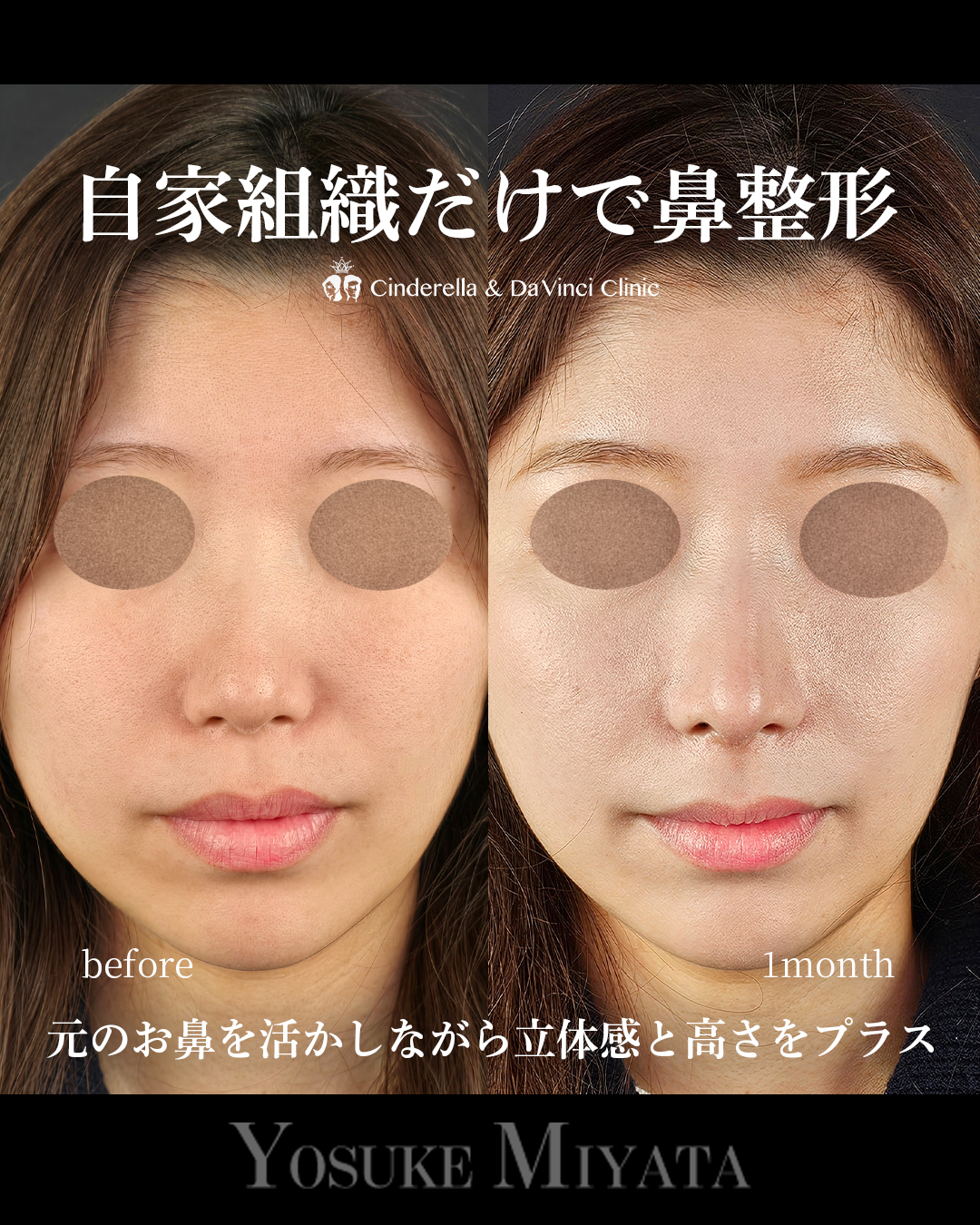 自家組織のみの画像