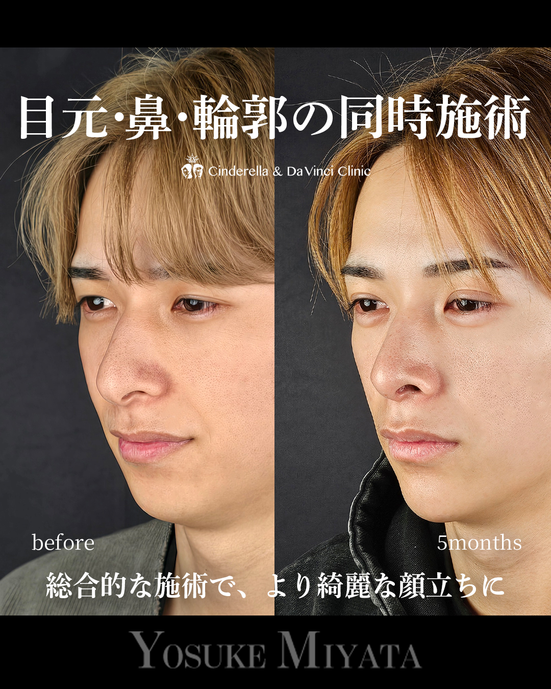 お顔全体アプデの画像