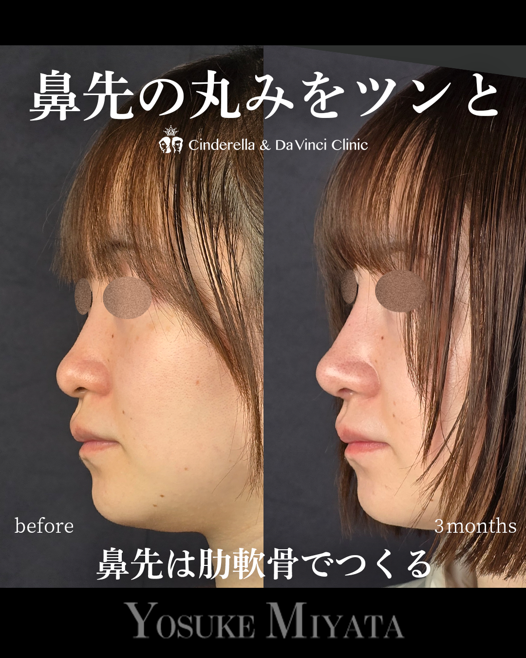 鼻先の丸みをツンとの画像