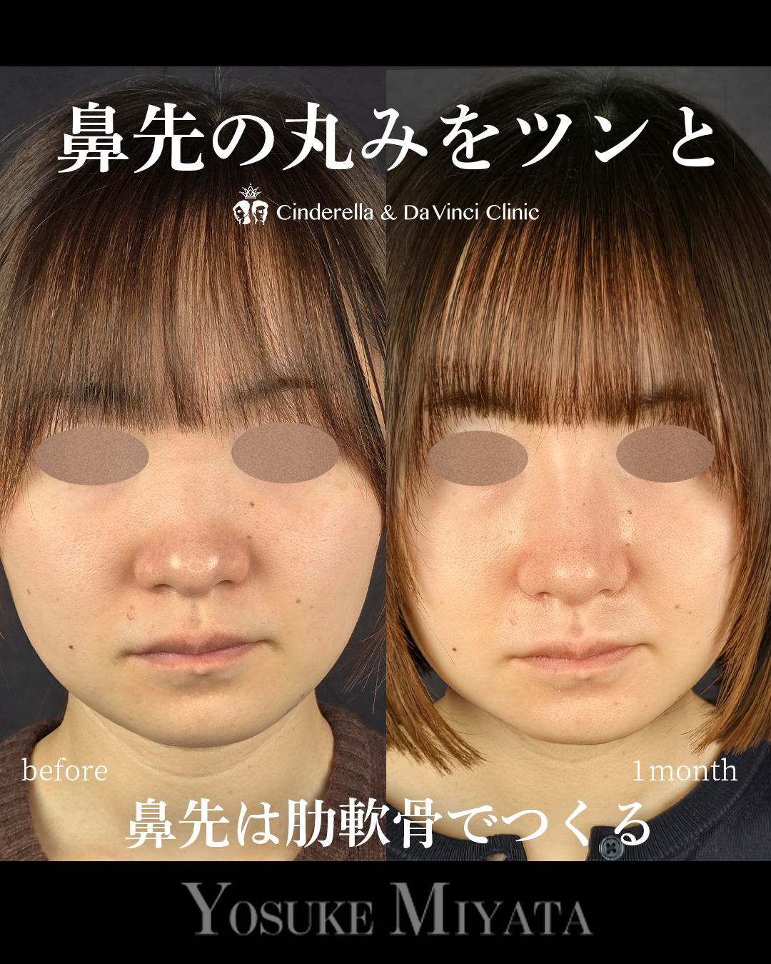 鼻先の丸みをツンとの画像