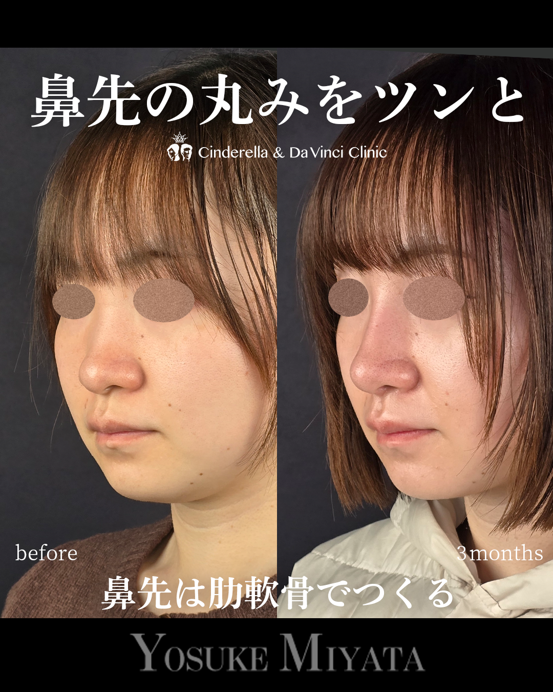 鼻先の丸みをツンとの画像