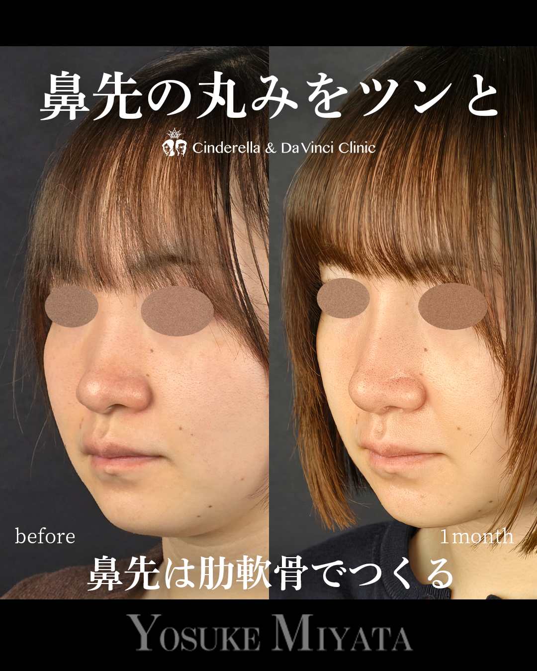 鼻先の丸みをツンとの画像