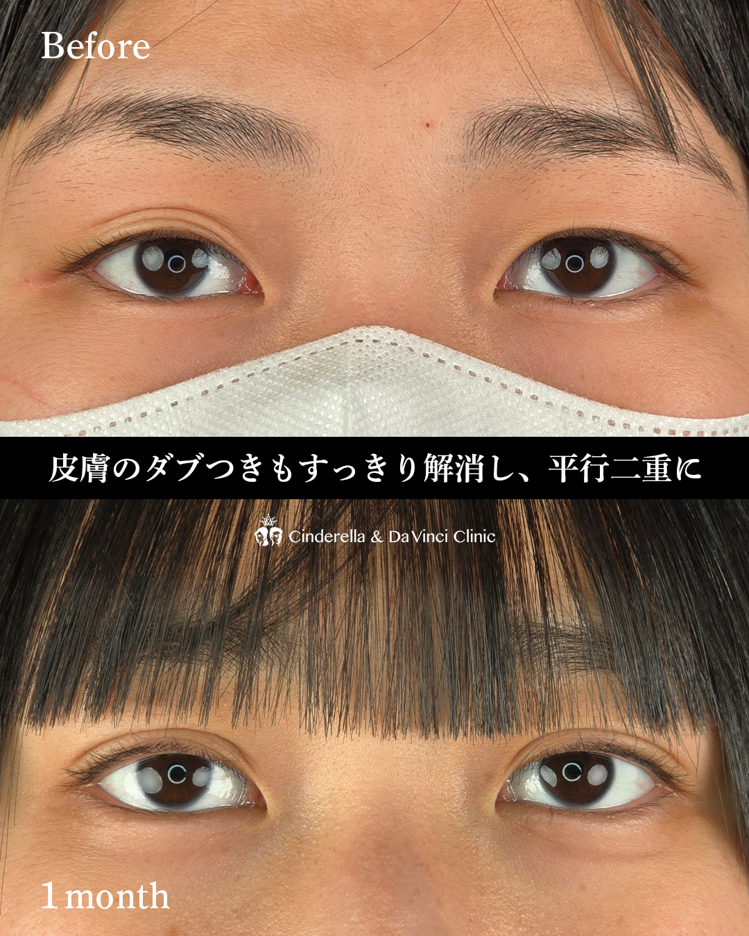 自然癒着で三重改善の画像