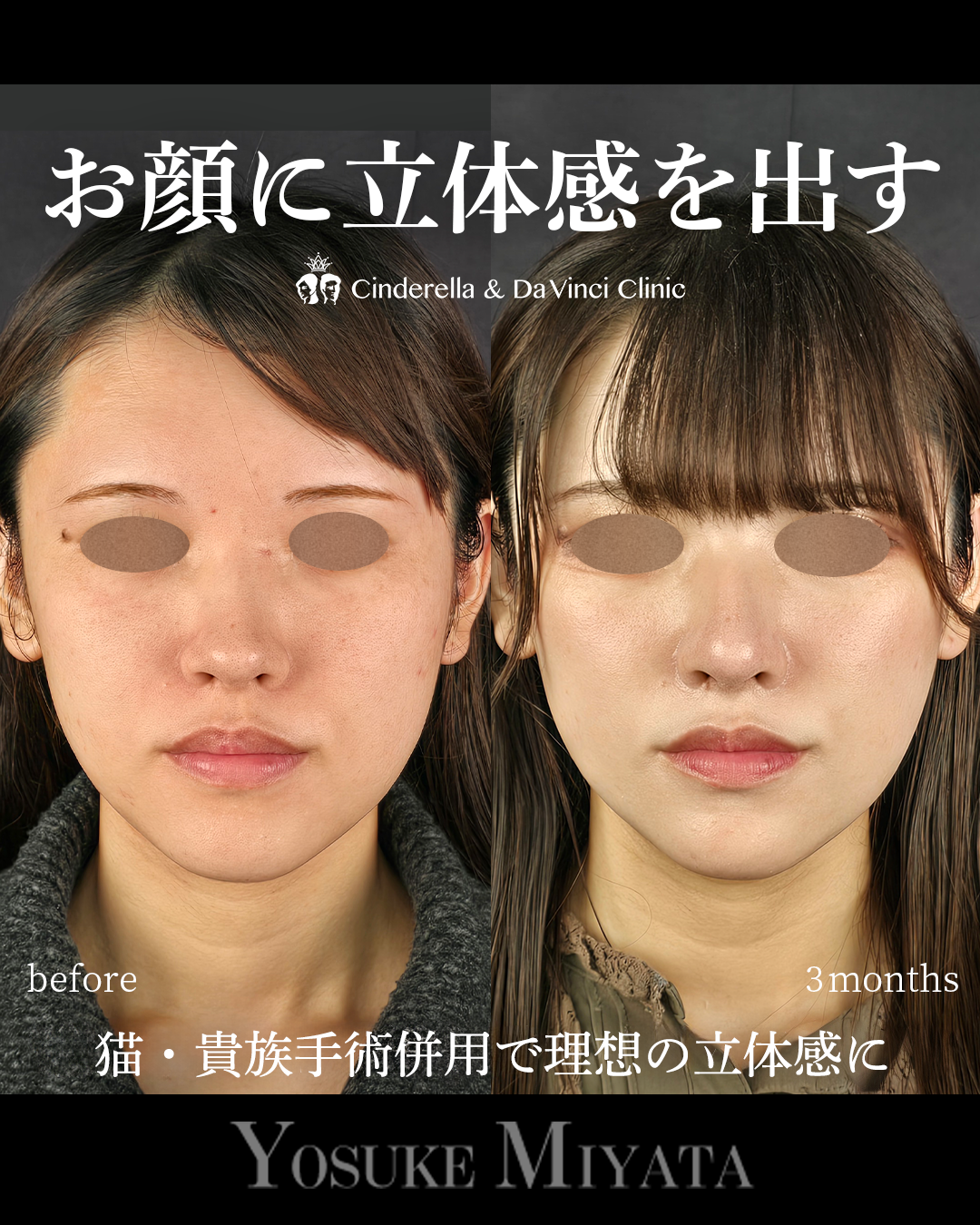 立体的な顔にの画像
