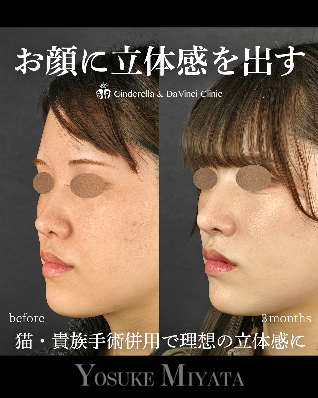 立体的な顔にの画像