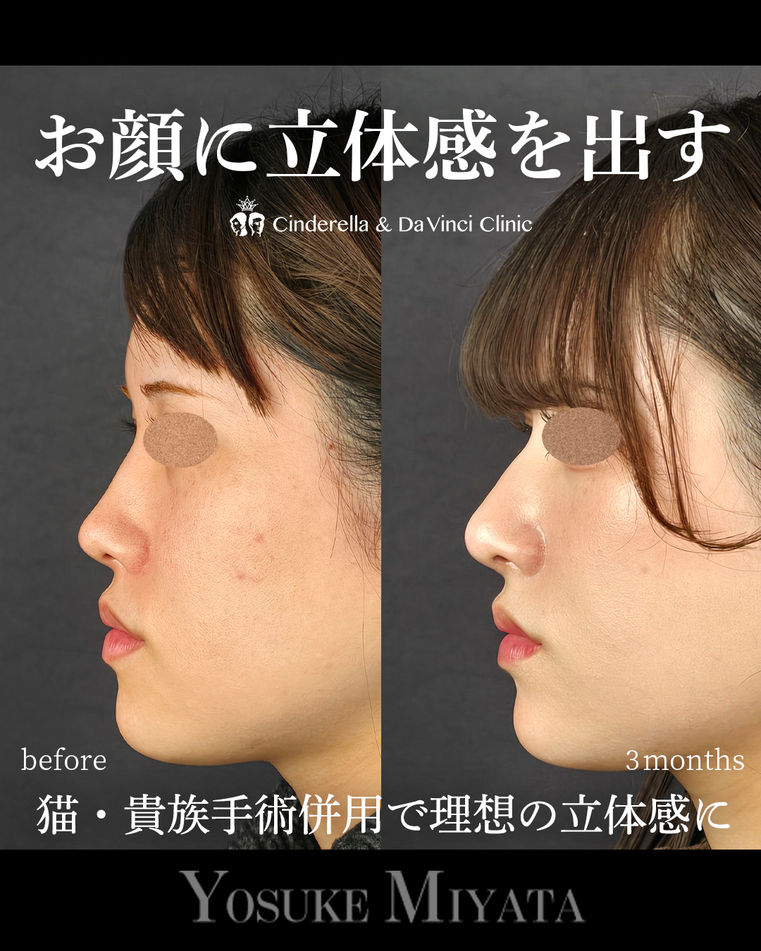 立体的な顔にの画像