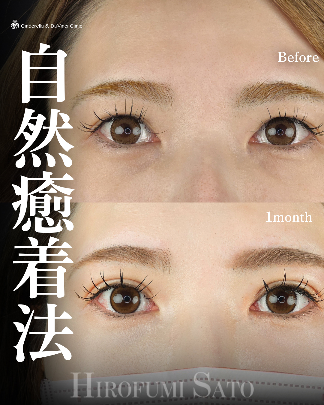 華やかな平行二重に