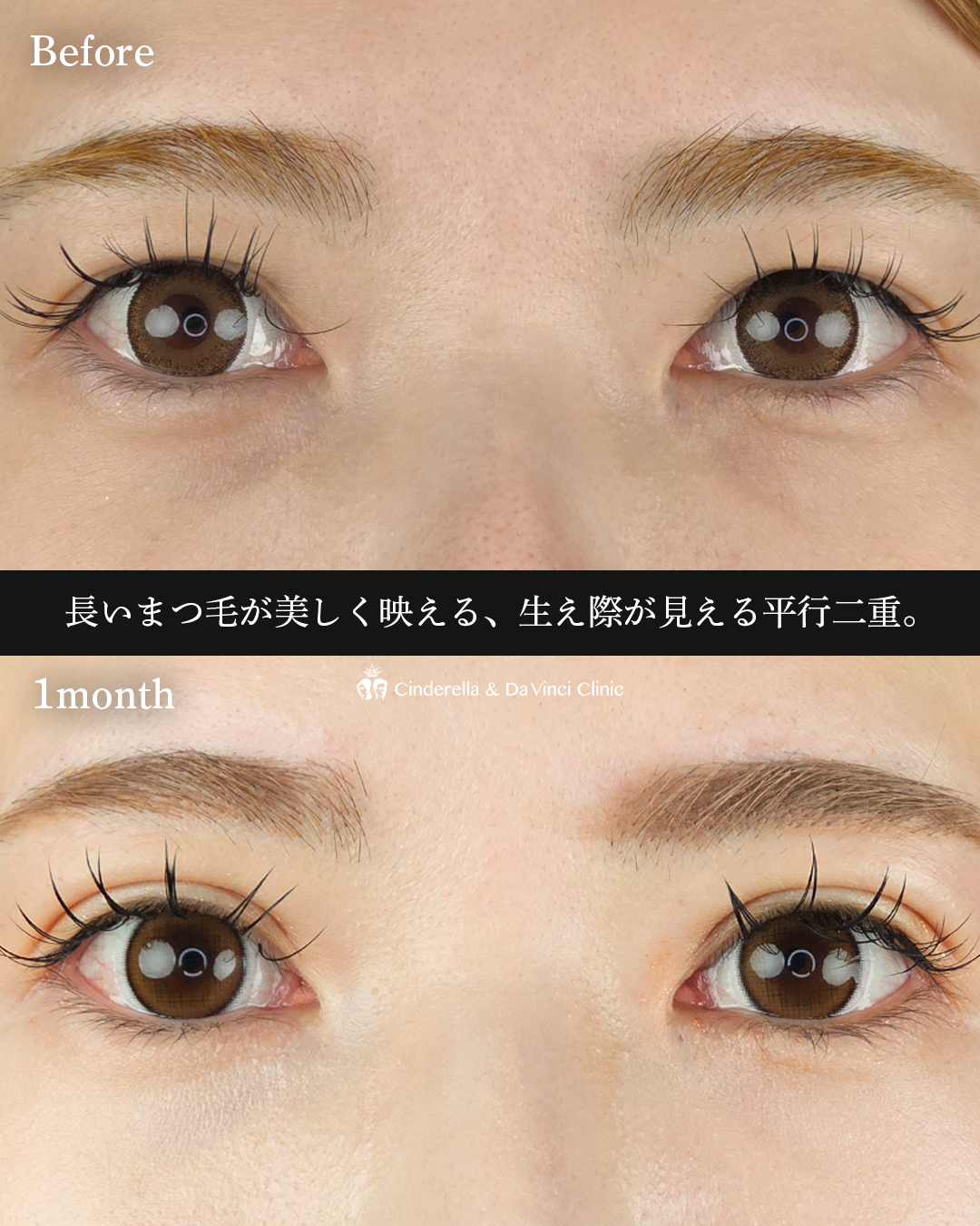 華やかな平行二重にの画像