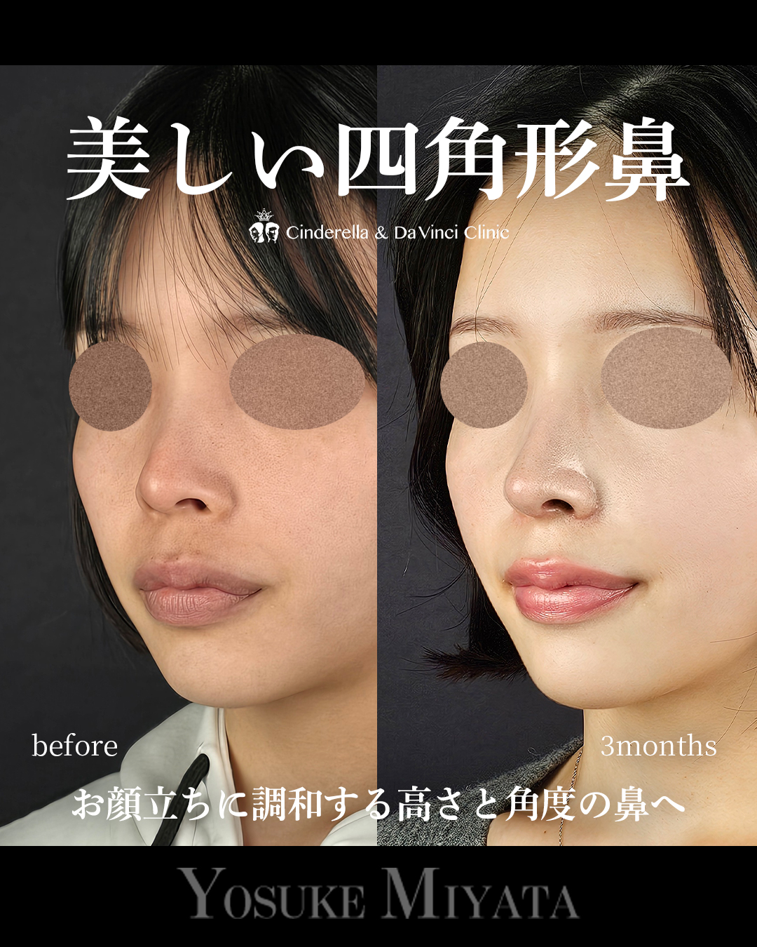 綺麗な四角形鼻の画像