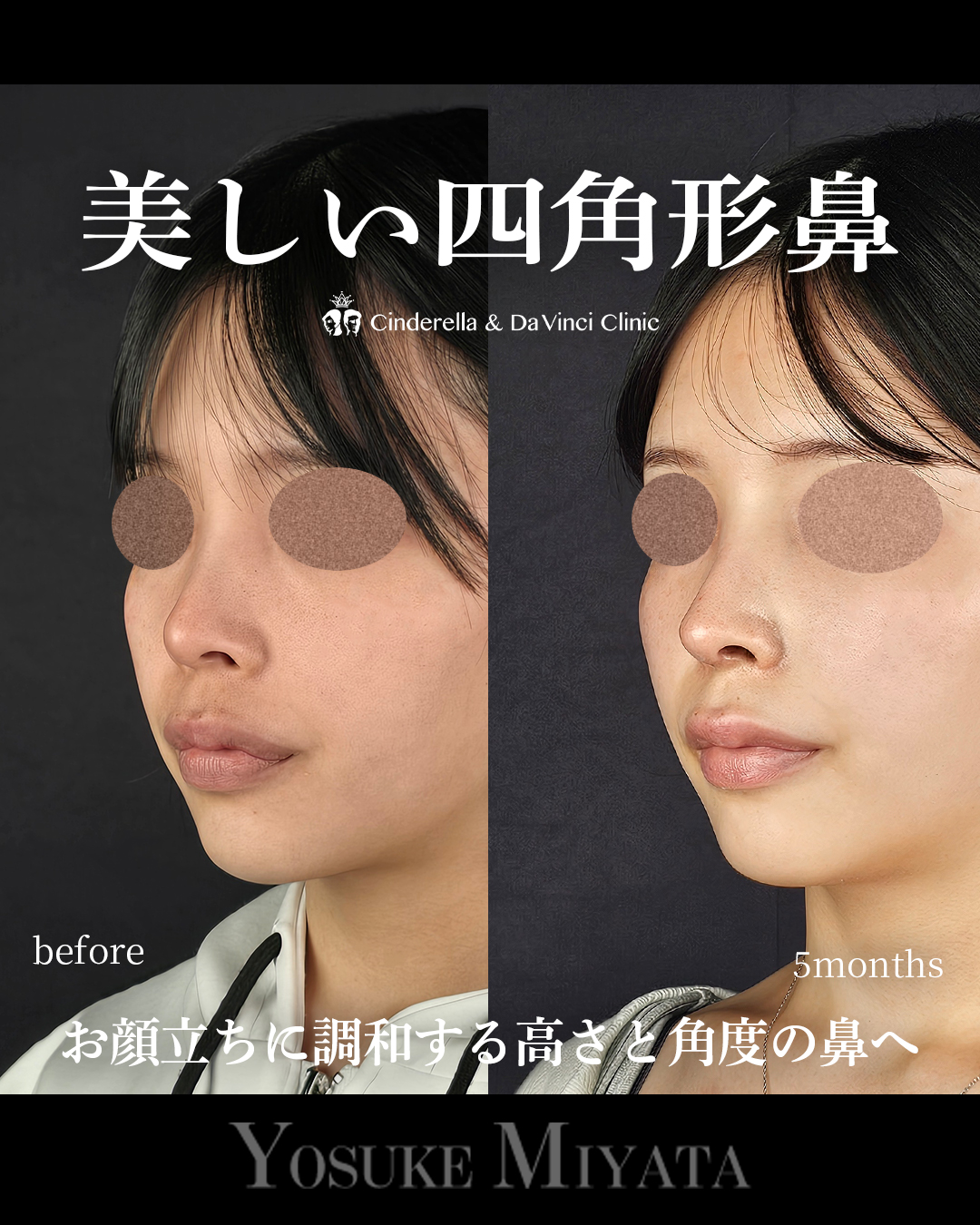 綺麗な四角形鼻の画像